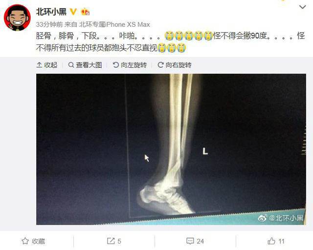 河南建业杨阔重伤